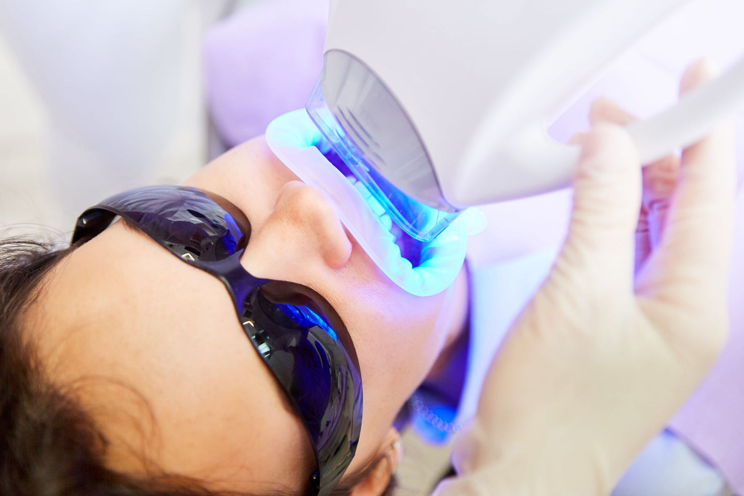 ORIGINAL EXTREMER - Dental White | The Smile Company Professionelle Zahnaufhellung